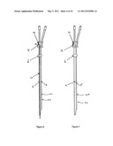 DUAL LUMEN DIALYSIS CATHETER WITH INTERNALLY BORED OR EXTERNALLY-GROOVED SMALL BORE diagram and image