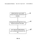 DUAL LUMEN DIALYSIS CATHETER WITH INTERNALLY BORED OR EXTERNALLY-GROOVED SMALL BORE diagram and image