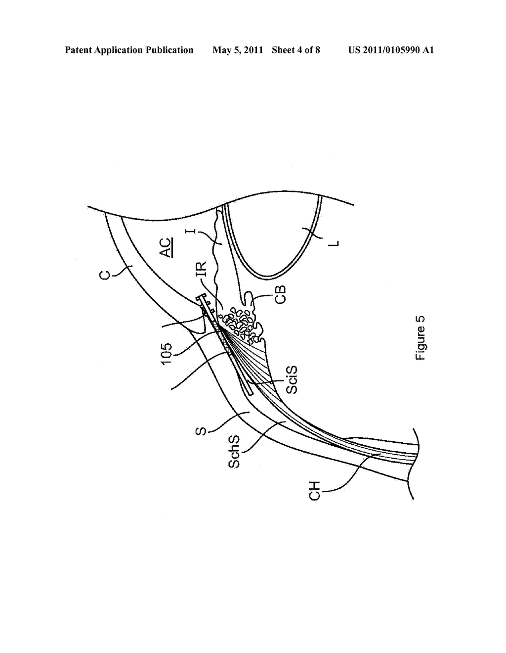 ZONAL DRUG DELIVERY DEVICE AND METHOD - diagram, schematic, and image 05