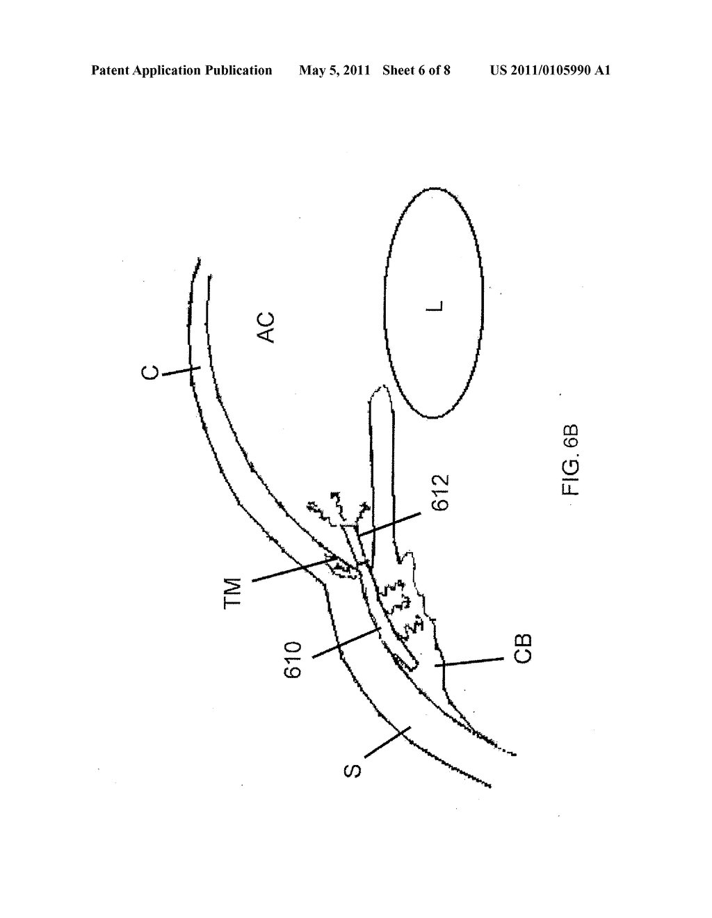 ZONAL DRUG DELIVERY DEVICE AND METHOD - diagram, schematic, and image 07