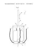 DEVICE FOR CELL TRANSPLANTATION diagram and image