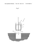 DEVICE FOR CELL TRANSPLANTATION diagram and image