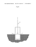 DEVICE FOR CELL TRANSPLANTATION diagram and image