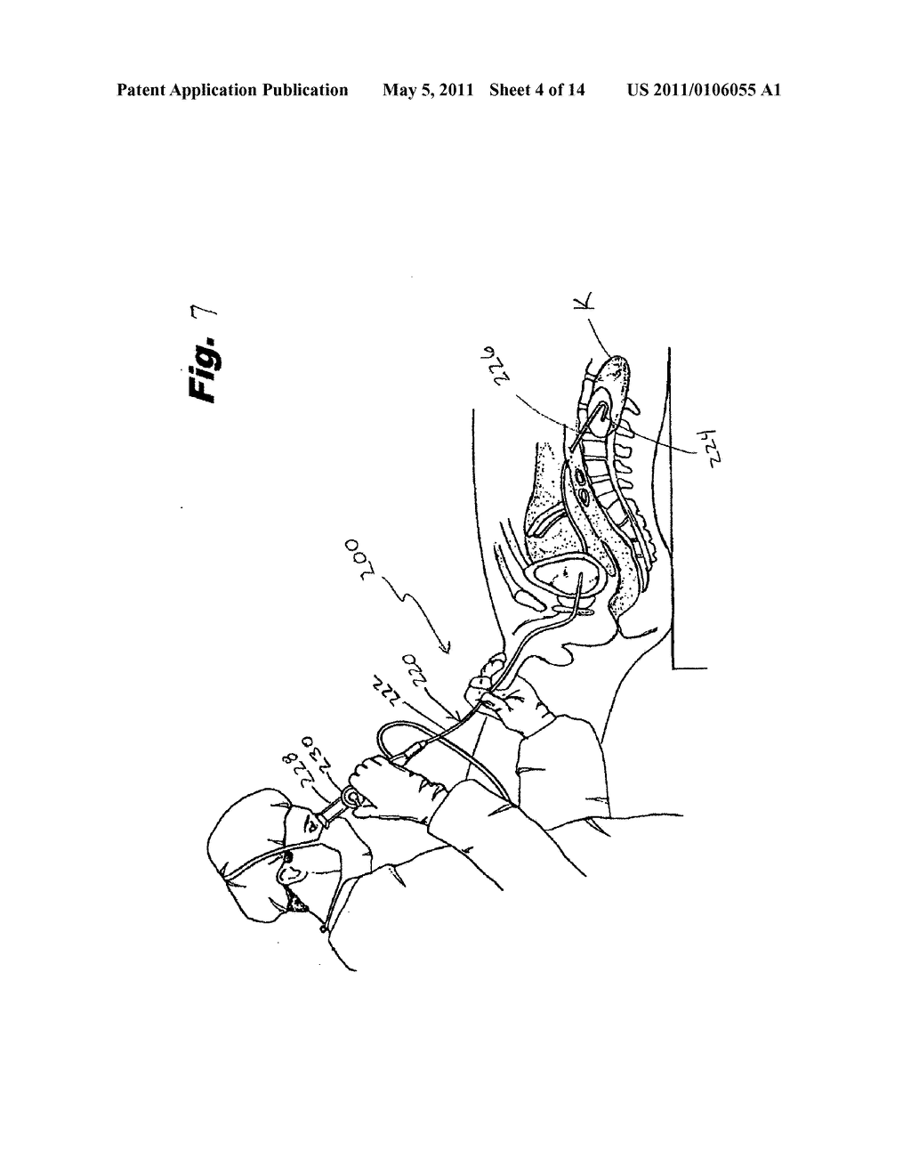 FLEXIBLE ENDOSCOPE WITH MODIFIABLE STIFFNESS - diagram, schematic, and image 05