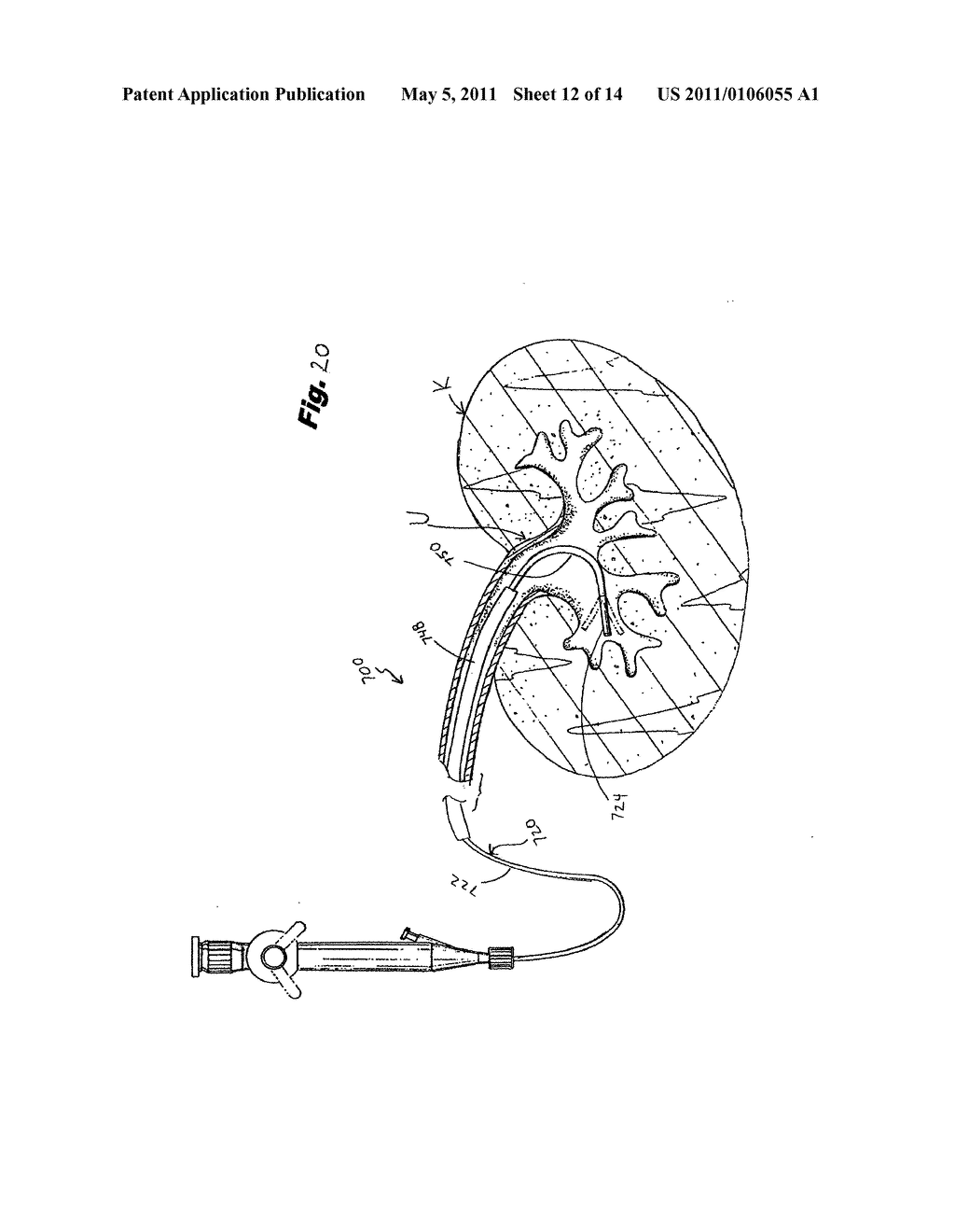 FLEXIBLE ENDOSCOPE WITH MODIFIABLE STIFFNESS - diagram, schematic, and image 13