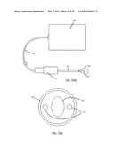 Low-Corrosion Electrode for Treating Tissue diagram and image