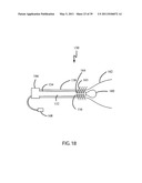 Low-Corrosion Electrode for Treating Tissue diagram and image