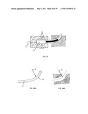 Low-Corrosion Electrode for Treating Tissue diagram and image