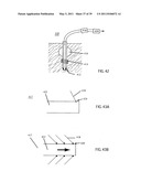 Low-Corrosion Electrode for Treating Tissue diagram and image