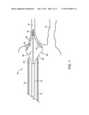 ABLATION CATHETER diagram and image