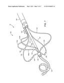 ABLATION CATHETER diagram and image