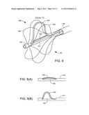 ABLATION CATHETER diagram and image