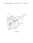 ABLATION CATHETER diagram and image