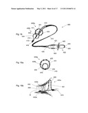 ABLATION CATHETER diagram and image