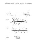 ABLATION CATHETER diagram and image