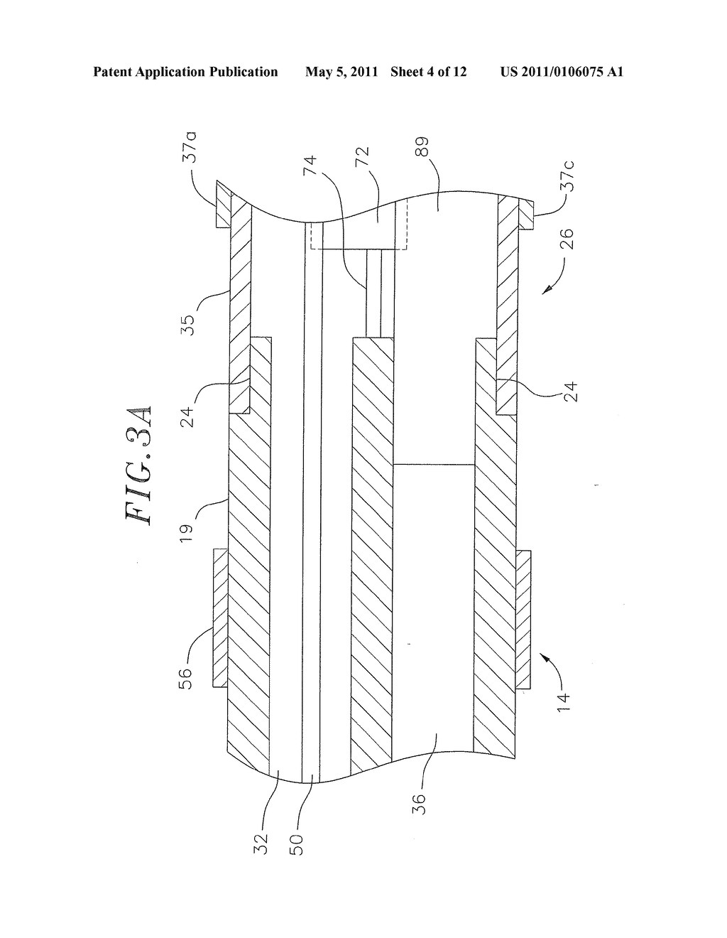 SYSTEM AND METHOD FOR SELECTIVELY ENERGIZING CATHETER ELECTRODES - diagram, schematic, and image 05