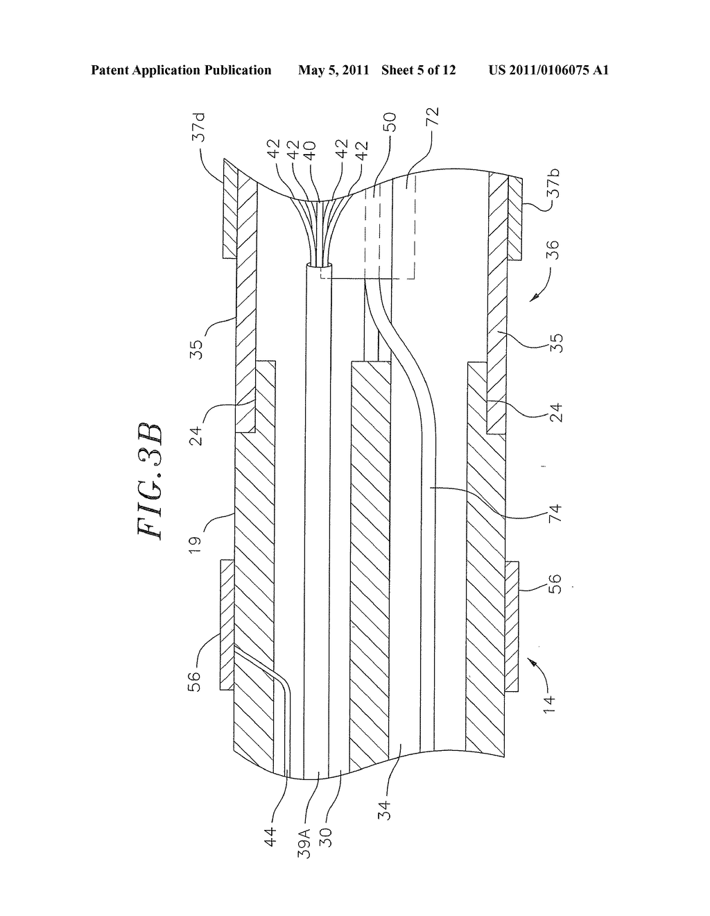 SYSTEM AND METHOD FOR SELECTIVELY ENERGIZING CATHETER ELECTRODES - diagram, schematic, and image 06