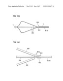 TREATMENT INSTRUMENT diagram and image