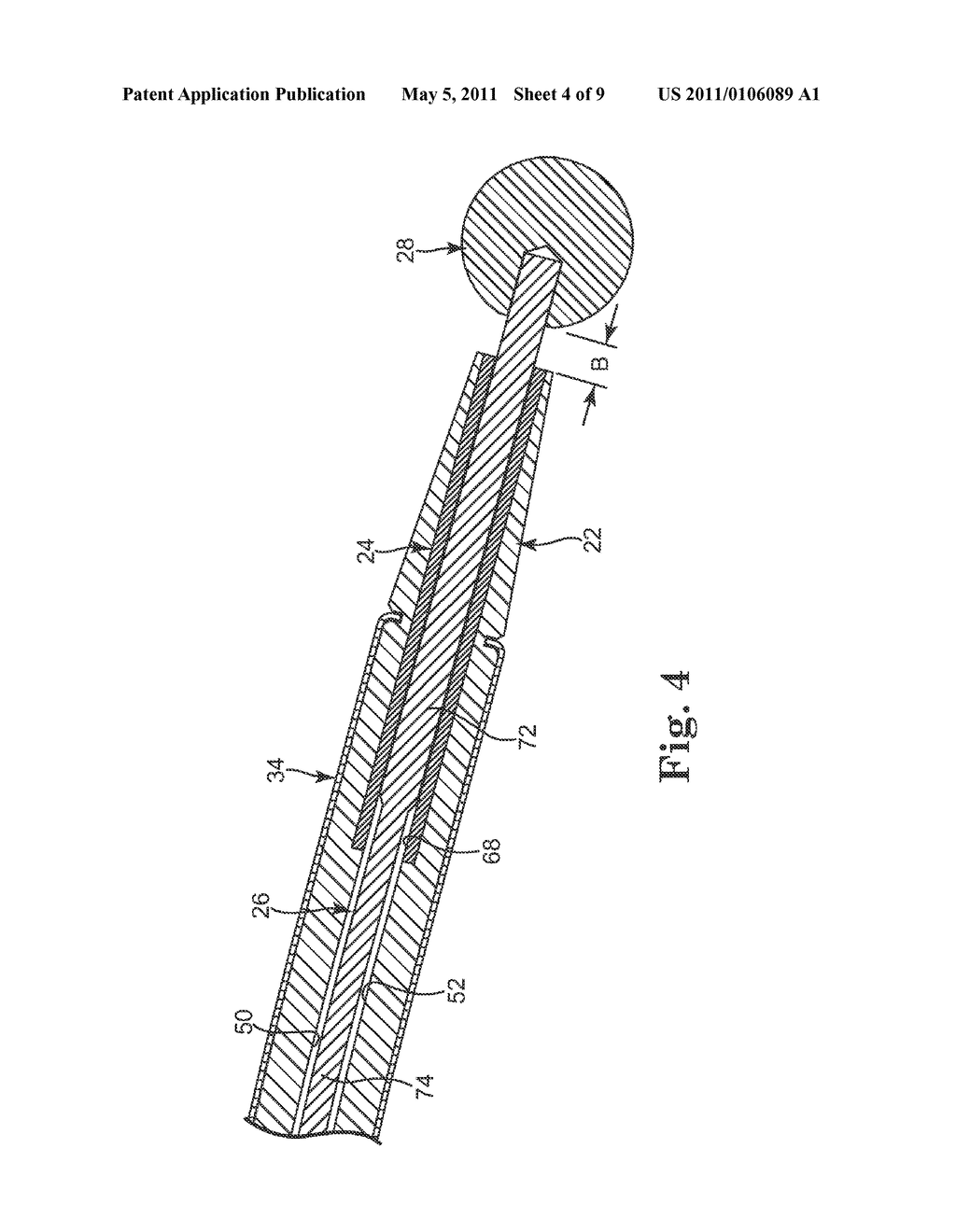 HIGH SPEED SURGICAL CUTTING INSTRUMENT - diagram, schematic, and image 05