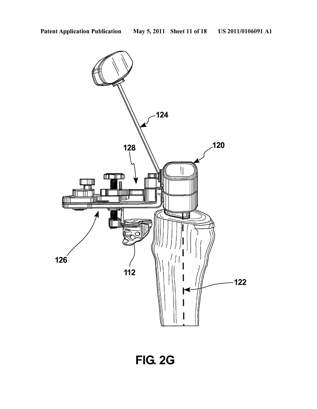 KNEE ARTHROPLASTY APPARATUS AND METHOD - diagram, schematic, and image 12