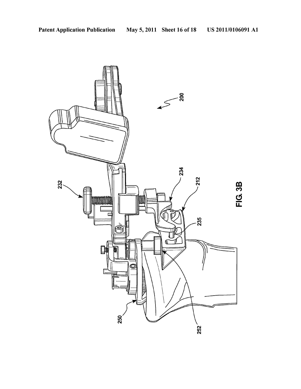 KNEE ARTHROPLASTY APPARATUS AND METHOD - diagram, schematic, and image 17