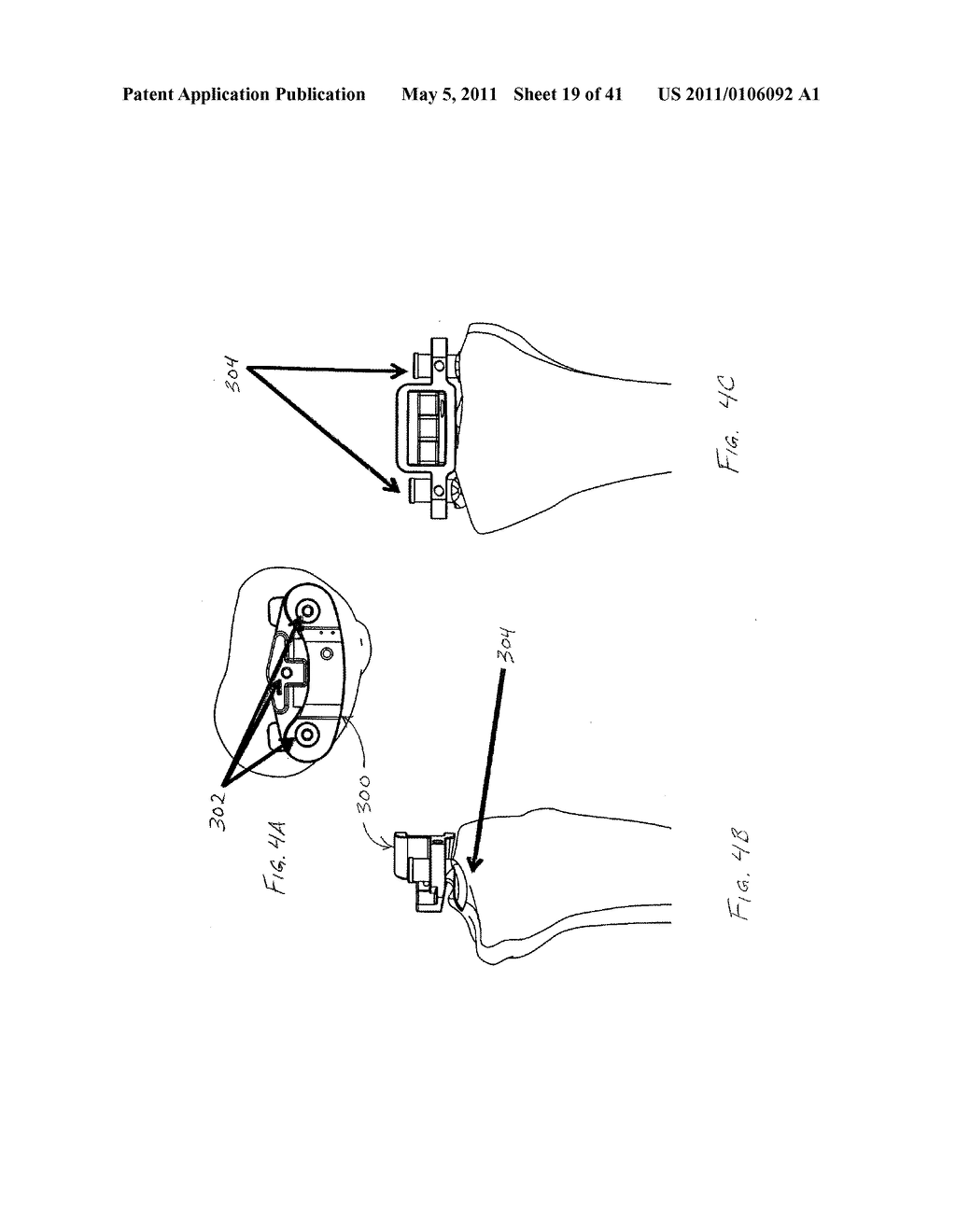 BONE POSITIONING DEVICE AND METHOD - diagram, schematic, and image 20