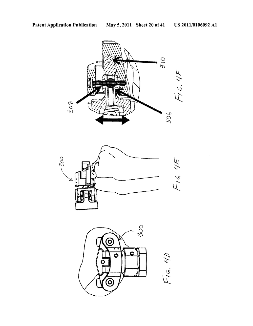 BONE POSITIONING DEVICE AND METHOD - diagram, schematic, and image 21