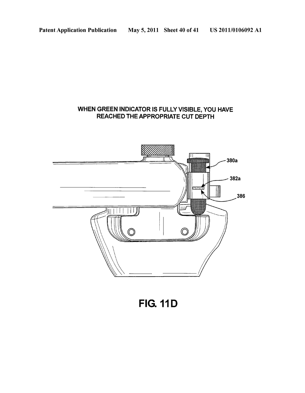 BONE POSITIONING DEVICE AND METHOD - diagram, schematic, and image 41