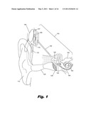 Steerable Stylet diagram and image