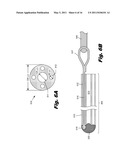 Steerable Stylet diagram and image