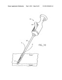 SNARED SUTURE TRIMMER diagram and image