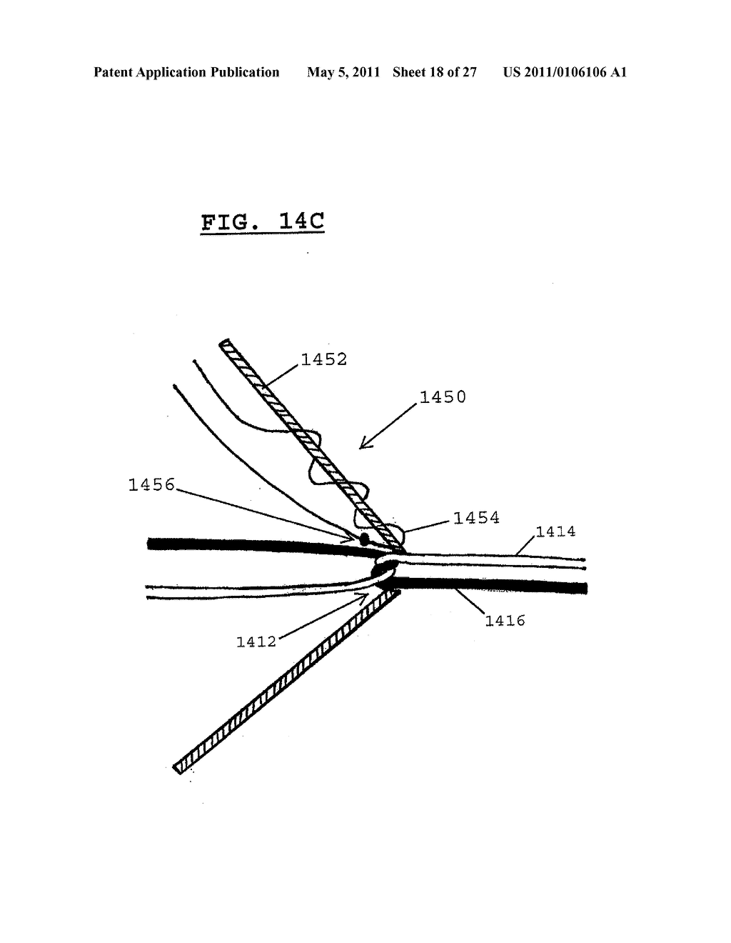 TERMINATION DEVICES AND RELATED METHODS - diagram, schematic, and image 19