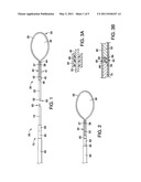 APPARATUS AND METHODS FOR MAINTAINING A FORCE UPON TISSUE USING A LOOP MEMBER diagram and image