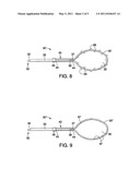 APPARATUS AND METHODS FOR MAINTAINING A FORCE UPON TISSUE USING A LOOP MEMBER diagram and image