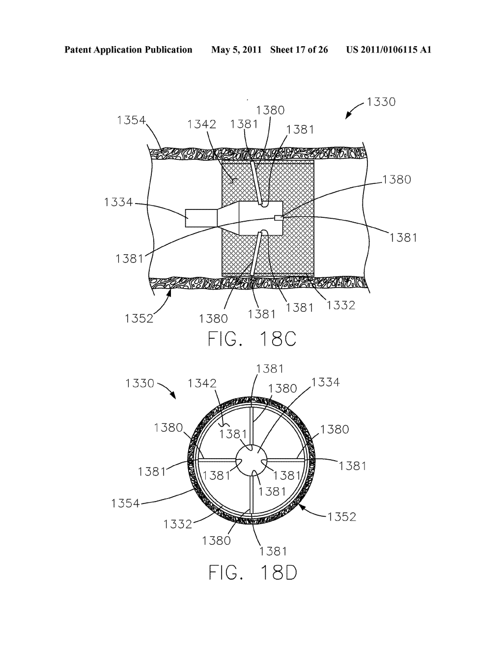 INTRAVASCULAR DEVICE ATTACHMENT SYSTEM HAVING STRUTS - diagram, schematic, and image 18