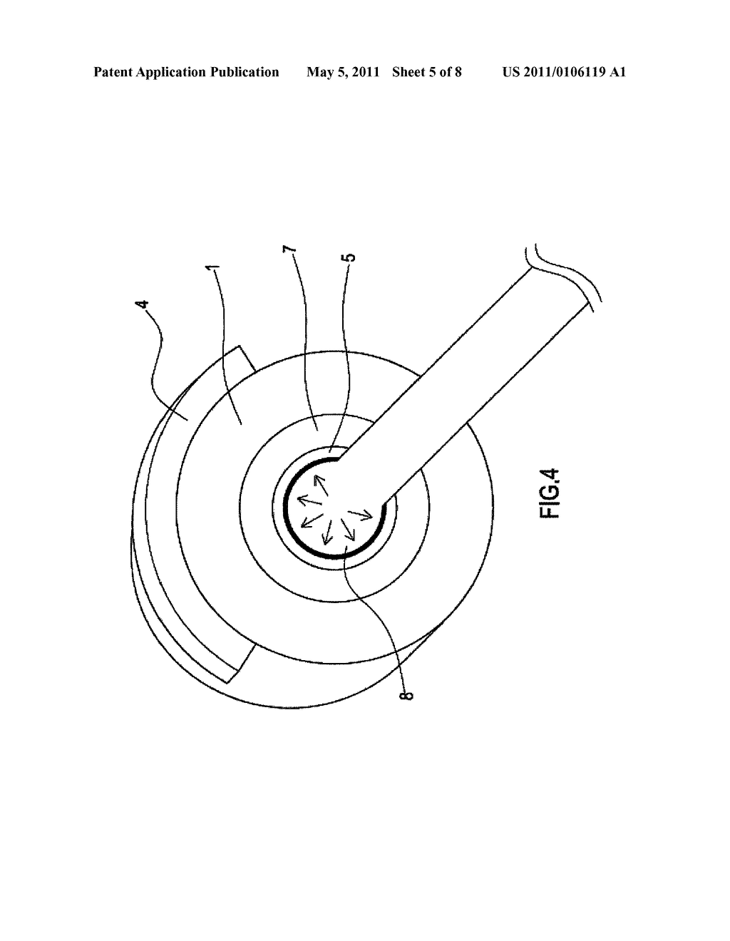 ANASTOMOSIS DEVICE - diagram, schematic, and image 06