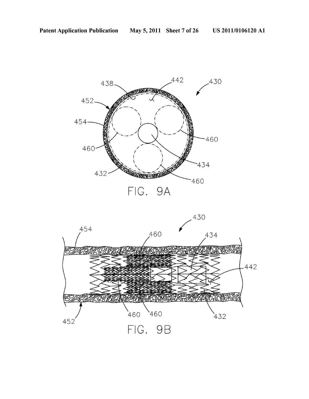 INTRAVASCULAR DEVICE ATTACHMENT SYSTEM HAVING TUBULAR EXPANDABLE BODY - diagram, schematic, and image 08