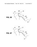 METHOD AND APPARATUS FOR ARTHROSCOPIC ROTATOR CUFF REPAIR USING TRANSOSSEOUS TUNNELS diagram and image