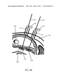 Methods and devices to treat obesity diagram and image