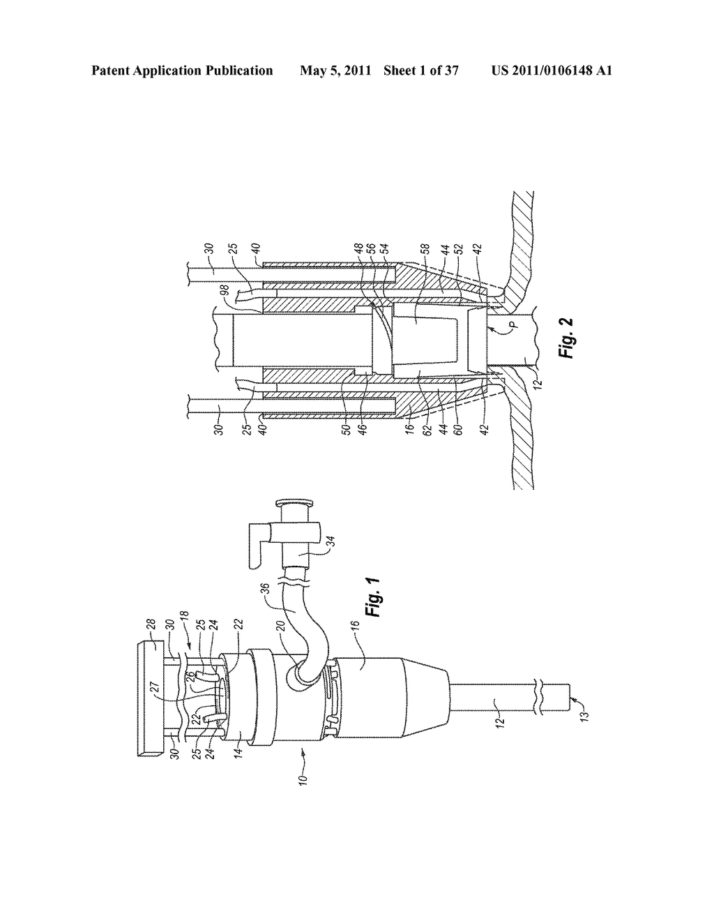 CLOSURE SYSTEM AND METHODS OF USE - diagram, schematic, and image 02