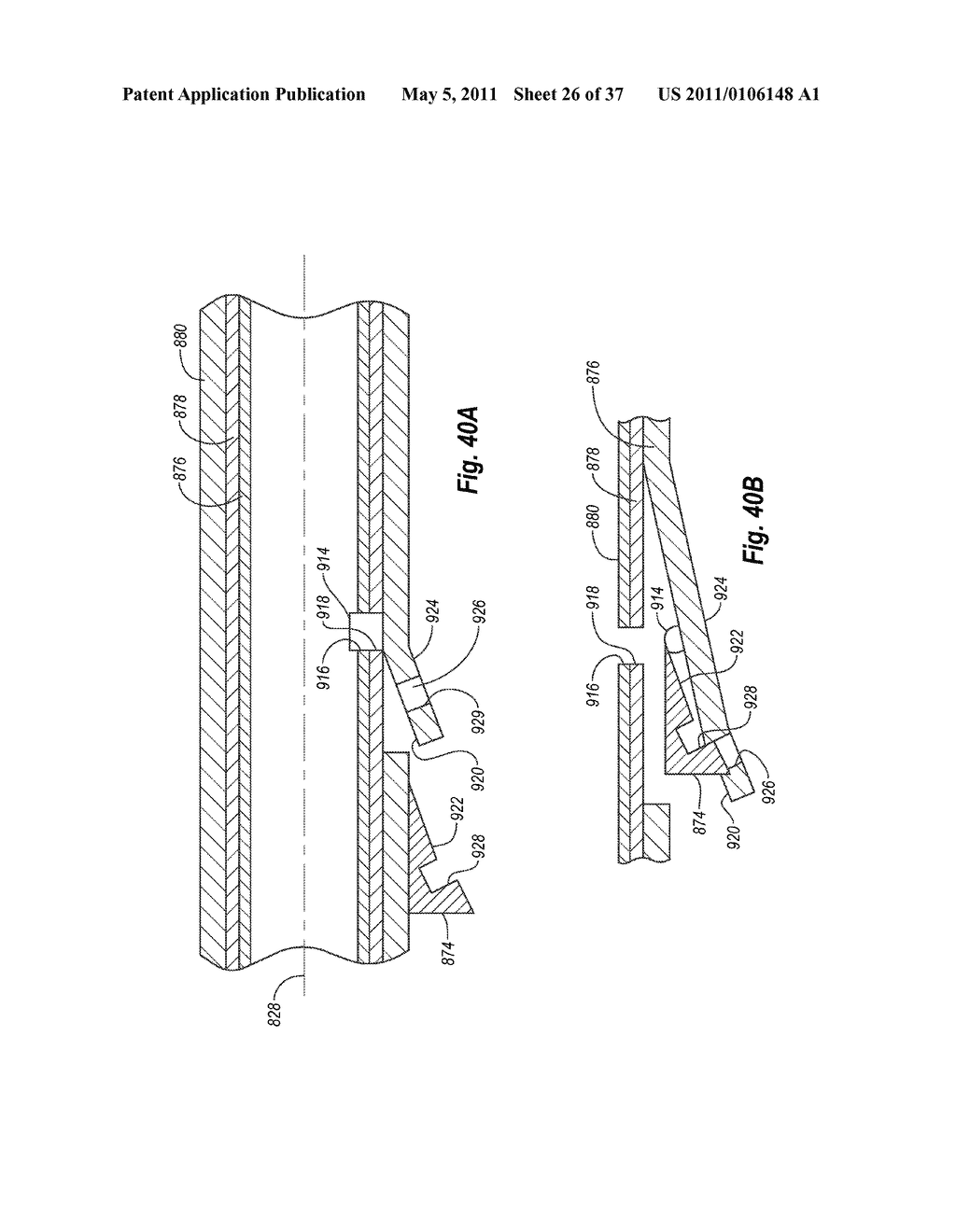 CLOSURE SYSTEM AND METHODS OF USE - diagram, schematic, and image 27