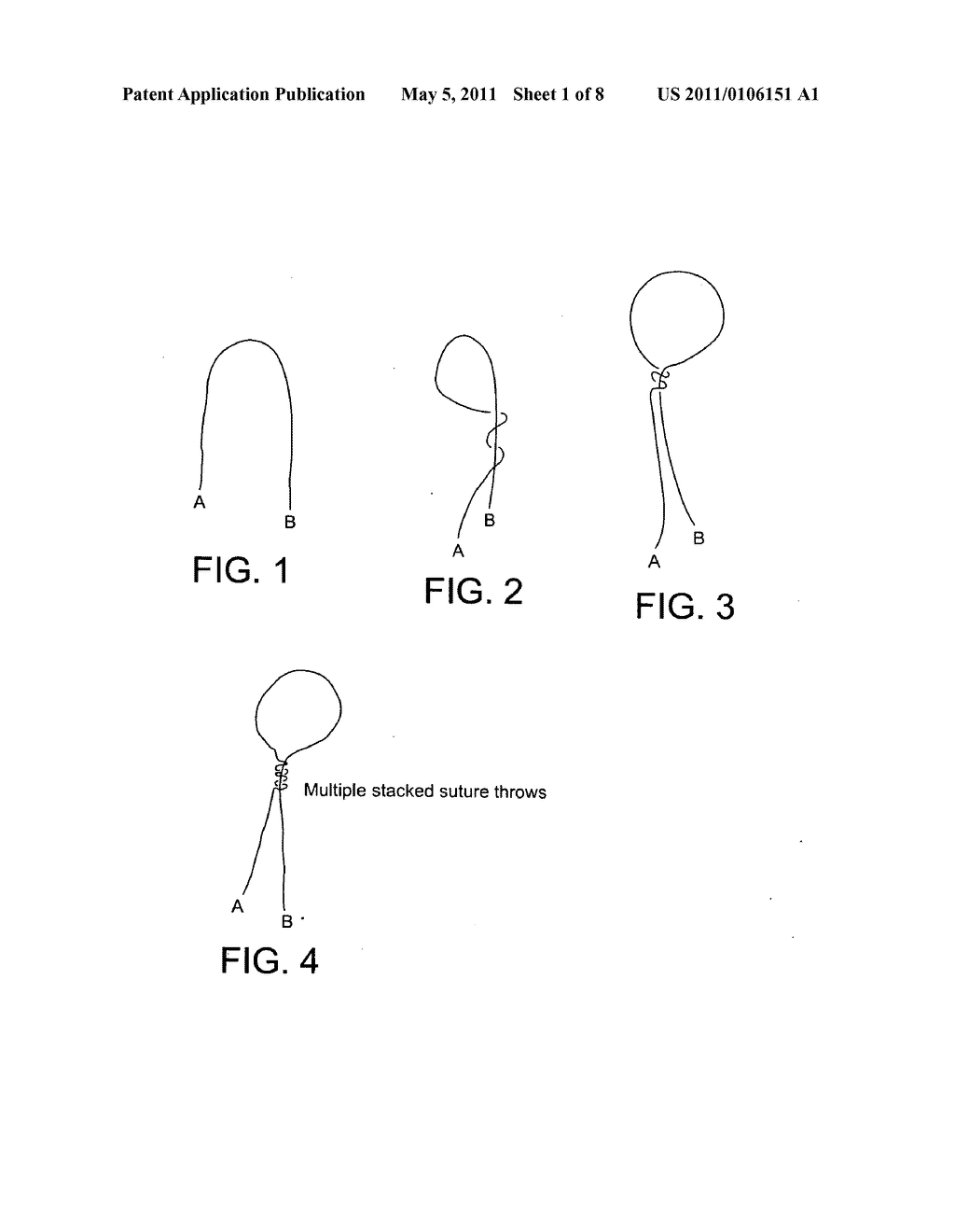 SQUARE LOCK SUTURE KNOT - diagram, schematic, and image 02