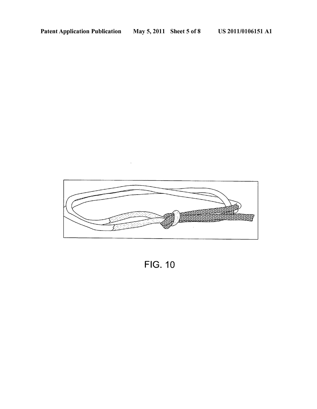 SQUARE LOCK SUTURE KNOT - diagram, schematic, and image 06