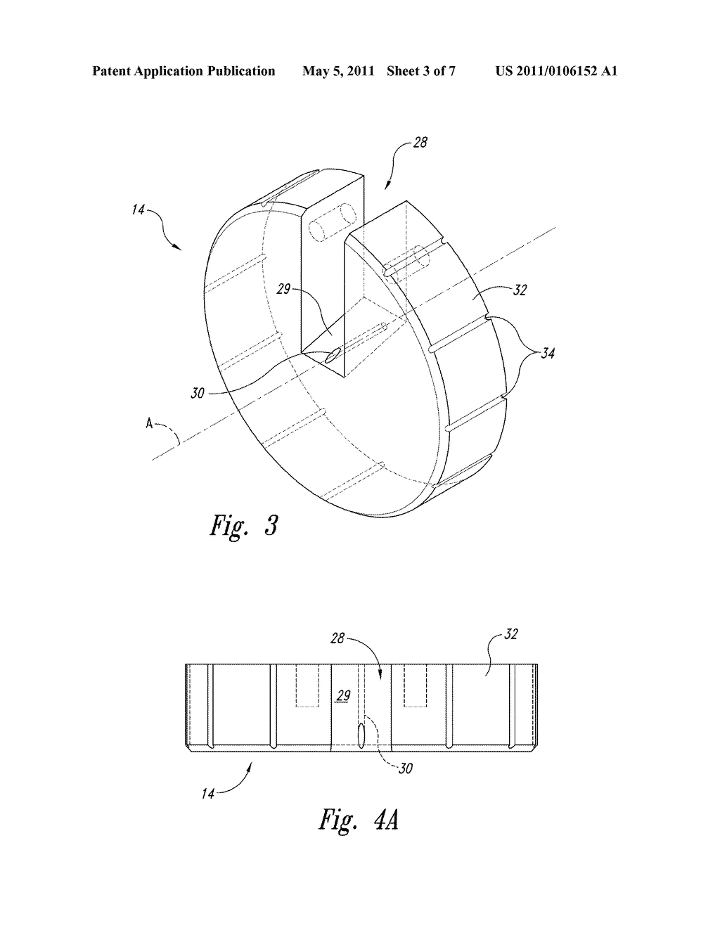 APPARATUS AND METHOD FOR FORMING SELF-RETAINING SUTURES - diagram, schematic, and image 04