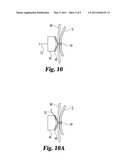 EXTERNAL RETENTION MECHANISM FOR SUTURE ANCHOR diagram and image