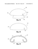 EXTERNAL RETENTION MECHANISM FOR SUTURE ANCHOR diagram and image