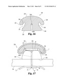 EXTERNAL RETENTION MECHANISM FOR SUTURE ANCHOR diagram and image