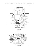 SYSTEMS AND METHODS FOR POSTERIOR DYNAMIC STABILIZATION OF THE SPINE diagram and image