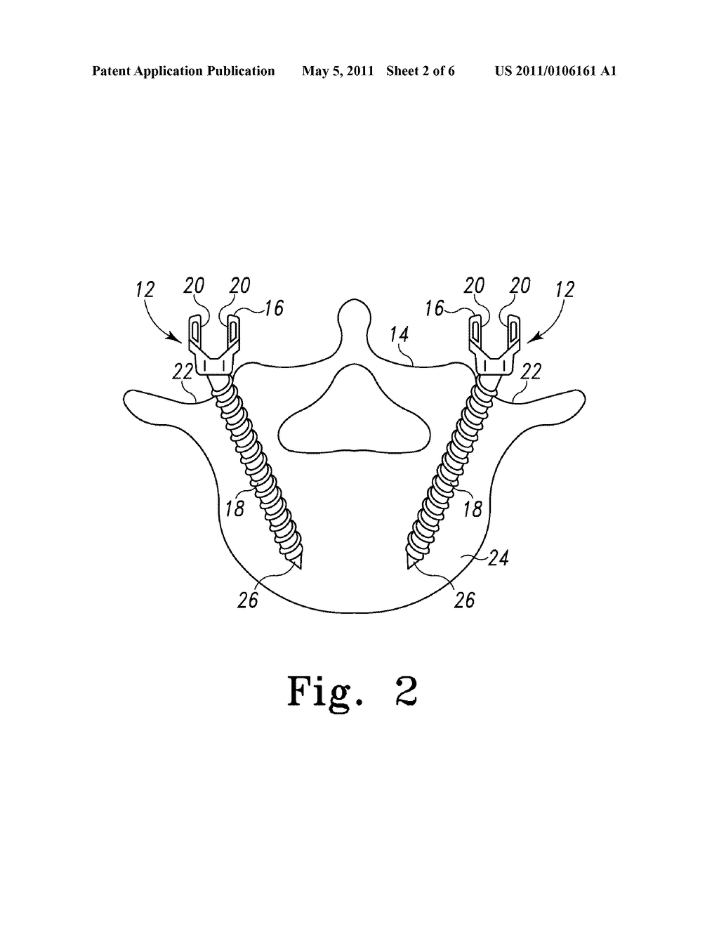 Position Retaining Crosslink - diagram, schematic, and image 03