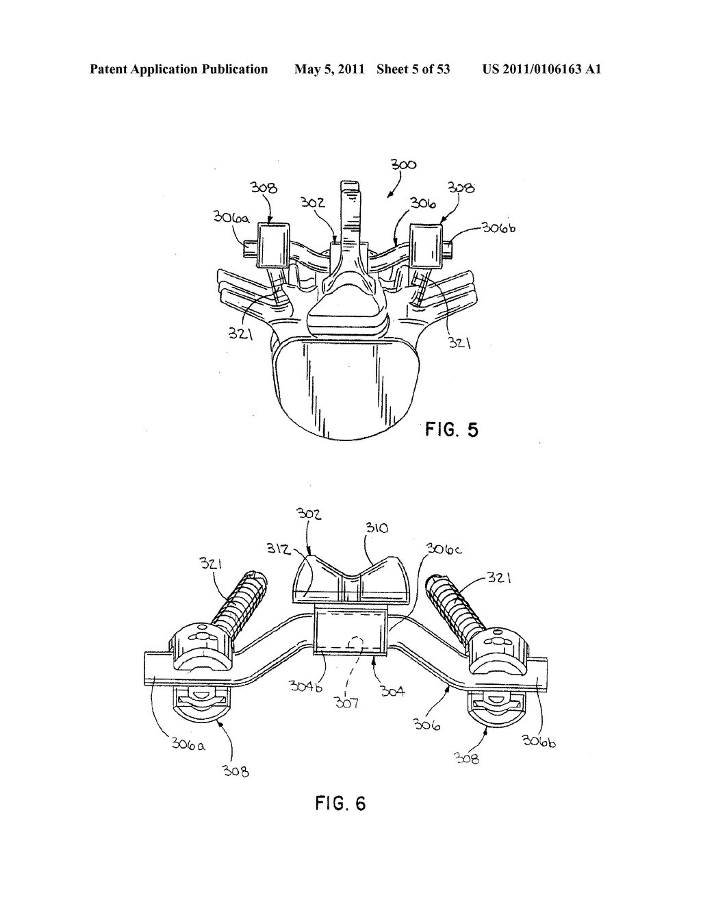 Interlaminar Stabilizing System - diagram, schematic, and image 06